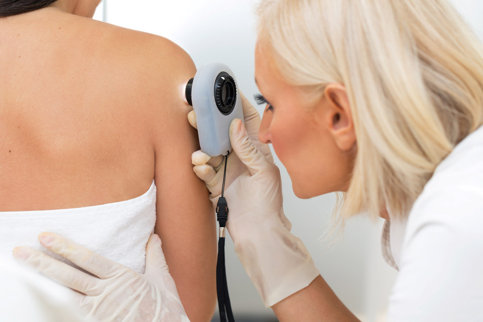 LiveWell-cancer-screenings skin-cancer-screenings